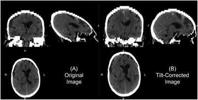 Recommendations for Processing Head CT Data